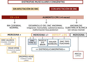 Algoritmo diagnóstico global de las distrofias musculares congénitas (DMC) principales La orientación diagnóstica de las DMC se hace en base a la afectación o no del sistema nervioso central (SNC), el nivel de enzimas musculares (normal o no muy elevado; marcadamente elevado), datos neuroradiológicos (RM cerebral normal, con anomalías estructurales o de la substancia blanca aisladas), inmunohistoquímicos (expresión de merosina y alfa distroglicano) y marcadores fenotípicos (hiperlaxitud distal, rigidez espinal, pérdida de sostén cefálico, hipertrofia muscular, sindrome cerebro-ocular (“Muscle-eye-brain” (MEB)). Sindrome de Walker-Warburg, DMC de tipo Fukuyama). Los pacientes inteligentes, con RM cerebral normal suelen tener nivel de CK normal o poco aumentadas, expresión de merosina normal y pueden tener tres tipos de DMC por mutación de los genes SEPN1, COL6 o LMNA fundamentalmente. Las formas con retraso mental o con aumento marcado de CKs pueden tener formas con déficit primario o secundario en merosina. Los déficits primarios son debidos a mutaciones del gen LAMA2 y se caracterizan por un respeto de las funciones cognitivas pero anomalías difusas de la substancia blanca cerebral. Los déficits de merosina secundarios tienen un déficit de glicosilación de alfa distroglicano (distroglicanopatías). El espectro de fenotipos de las distroglicanopatías es muy extenso, desde pacientes sin retraso mental, hasta otros con retraso y malformaciones cerebro-oculares o de fosa posterior, o anomalías de substancia blanca supratentorial de extensión variable).