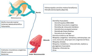 Diagrama de las enfermedades neuromusculares más frecuentes según la topografía de la afectación la unidad motora Modificado de Hammer GD, McPhee SJ: Fisiopatología de la enfermedad 7e: www.accessmedicina.com