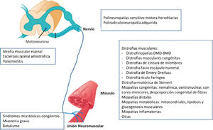 Diagrama de las enfermedades neuromusculares más frecuentes según la topografía de la afectación la unidad motora Modificado de Hammer GD, McPhee SJ: Fisiopatología de la enfermedad 7e: www.accessmedicina.com