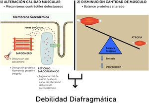 Mecanismos implicados en la pérdida de fuerza del diafragma en los pacientes críticos.