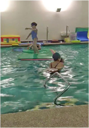 Piscina terapéutica en paciente con en SDRC.