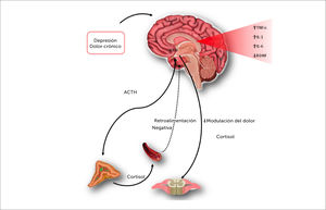 Un estresor crónico activará el HHA y aumenta la liberación de cortisol. La persistencia del estímulo provoca la pérdida de la retroalimentación negativa. La liberación permanente de cortisol da paso a cambios desadaptativos que desregulan los factores inflamatorios. La elevación de citoquinas disminuye el Factor Neutrófico Derivado del Cerebro (BDNF) y la neurogénesis impactando negativamente en la transmisión monoaminérgica. La vía descendente del dolor, dependiente de monoaminas, pierde su capacidad de inducir analgesia [30,31].