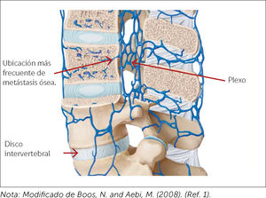 Plexo de Batson. Nota: Modificado de Boos, N. and Aebi, M. (2008). (Ref. 1).