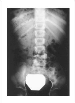 Radiografía que muestra la imagen de “Buho Tuerto”.