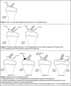 Clasificación de Green & Tuca.