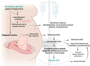 Curso de acción básico de un procedimiento EXIT. Diagrama de flujo que ilustra los pasos fundamentales para llevar a cabo un procedimiento EXIT, desde la anestesia general hasta la finalización del parto. Creado con software BioRender.