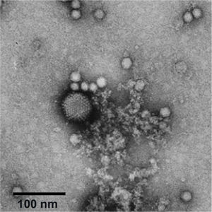 Adenovirus y virus adenoasociado. La microfotografía electrónica muestra un adenovirus rodeado de virus adenoasociados. Los virus adenoasociados son virus pequeños que dependen del adenovirus para poder infectar. Son de tamaño pequeño, no generan una respuesta inmune y no se han asociado a enfermedades en humanos. Los virus adeno-asociados son una gran herramienta para terapia génica ya que su modificación en el laboratorio permite utilizarlos como vectores para la entrega de material genético en una gran diversidad de tipos celulares. Imagen editada de http://www.virology.net/Big_Virology/BVDNAparvo.html.
