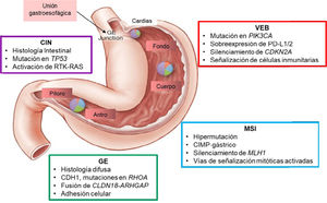 Los cuatro subtipos moleculares del adenocarcinoma gástrico descritos en el estudio TCGA, sus patrones mutacionales y ubicación. Abreviaturas: CIN: inestabilidad cromosómica; VEB: virus de Epstein-Barr; GE: unión gastroesofágica; GE: genómicamente estable; MSI: inestabilidad microsatelital. Este esquema describe algunas de las características más destacadas asociadas con cada uno de los cuatro subtipos moleculares de cáncer gástrico. La distribución de subtipos moleculares en tumores obtenidos de distintas regiones del estómago se representa mediante gráficos insertados. Traducido con licencia (CC BY-NC-SA 3.0) sin modificaciones de: Cancer Genome Atlas Research Network. Comprehensive molecular characterization of gastric adenocarcinoma. Nature. 2014;513(7517):202-9. doi: 10.1038/nature13480. (Ref.64).