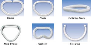 Anillos protésicos mitrales. Anillos protésicos mitrales Edwards Lifesciences®, Irvine, California, en concordancia con los principios de Carpentier. El anillo Classic fue el primer anillo diseñado por Alain Carpentier y utilizado principalmente en la valvulopatía reumática. El anillo Physio-Ring® fue diseñado por este para la insuficiencia mitral degenerativa o mixomatosa; posteriormente este anillo se rediseñó aumentando el diámetro anteroposterior y con un formato en “silla de montar”, con el nombre de Physio-Ring II® y es el más utilizado en la actualidad. El anillo Myxo-ETlogix® fue diseñado con este mismo propósito, pero no tuvo aceptación, al igual que el anillo GeoForm® para la insuficiencia mitral ventricular. El anillo Carpentier-McCarthy-Adams® fue diseñado por estos para la insuficiencia mitral isquémica e incluye ya una sobre reducción del anillo mitral. El anillo Cosgrove® es en la práctica una “banda” posterior y si bien tuvo en su momento una gran aceptación, ya que supuestamente preservaba la flexibilidad del anillo mitral nativo, esta fue menguando progresivamente, puesto que no cumple con una premisa básica de la anuloplastía, cual es remodelar el anillo mitral dilatado a su forma nativa, que se asemeja a un riñón.