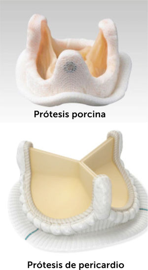 Prótesis biológicas.