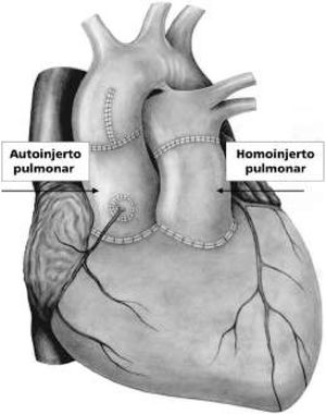 Esquema de operación de Ross19.