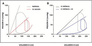 Curva Presión Volumen Ventrículo Izquierdo (VI). Curva Presión Volumen VI, ilustrando los cambios hemodinámicos en shock cardiogénico agudo en pacientes con función cardíaca normal y con insu- ficiencia cardíaca previa.