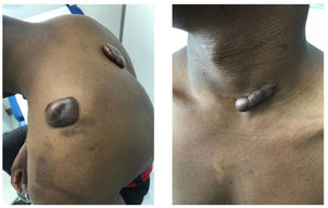 Paciente en primera consulta. Sin tratamientos previos.