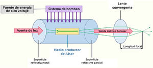 Esquema de funcionamiento general de los láseres. Modiﬁcado de Nouri et al24 y Kuehlmann et al.25.