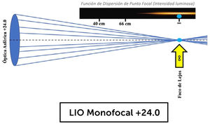 Lente intraocular monofocal Ej. Lente intraocular TECNIS® de Johnson & Johnson Vision; Lente intraocular Acrysof ®IQ SN60WF de Alcon.
