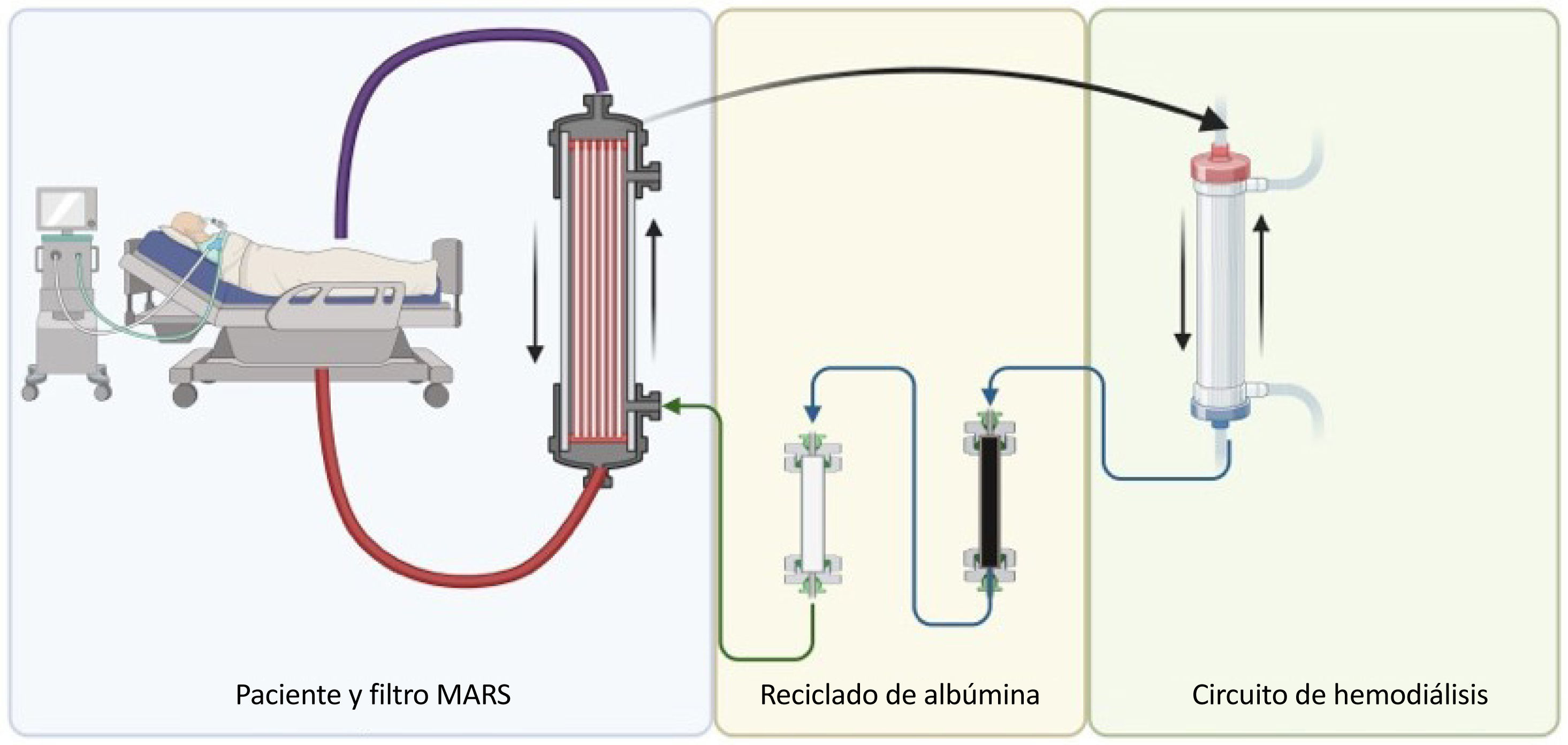 diagrama de plasmaféresis