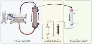 Esquema del sistema MARS (Molecular Adsorbent Recirculating System).