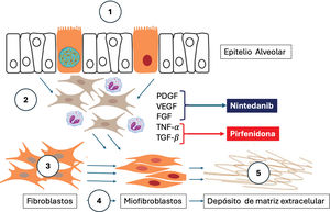 Fisiopatología de la enfermedad pulmonar intersticial (EPI) y blancos de acción de la pirfenidona y el nintedanib Adaptado de Shumar JN et al. (2021)30 y Spagnolo P et al (2021)31. 1. Epitelio alveolar donde ocurren mecanismos genéticos y epigenéticos (mutaciones que afectan la longitud telomérica, la síntesis de surfactante pulmonar y la mucina; y metilaciones del DNA, modificaciones de histonas y RNA no codificante) inducidos por estímulos patogénicos reiterados como infecciones respiratorias, reflujo gastroesofágico (RGE), tabaquismo, polución y la inhalación de sustancias nocivas. 2. La respuesta inflamatoria inicial implica la migración de fibroblastos, linfocitos TH1 y TH2 y neutrófilos. En estados anormales, se liberan citocinas inflamatorias como el factor de crecimiento derivado de plaquetas (PDGF), el factor de crecimiento endotelial vascular (VEGF), el factor de crecimiento de fibroblastos (FGF), el factor de necrosis tumoral alfa (TNF-α) y el factor de crecimiento transformante beta (TGF-β), que son dianas para los tratamientos antifibróticos como nintedanib y pirfenidona. 3. Proliferación de fibroblastos. 4. Transformación descontrolada de fibroblastos en miofibroblastos con pérdida de mecanismos de apoptosis. 5. Depósito excesivo de matriz extracelular y fibrosis28,29.