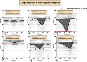Carga hipóxica e índice apnea-hipopnea La figura 1 muestra diferentes ejemplos de la carga hipóxica específica durante un episodio de apnea del sueño. Junto con la carga hipóxica, se muestra el índice de apnea hipopnea (IAH). La carga hipóxica total se define como la suma de las cargas individuales dividida por el tiempo total de sueño en asociación con los eventos respiratorios. El bracket rojizo de cada figura (desde la letra A hasta la F muestra el área bajo la curva de SpO2.