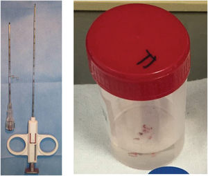 Aguja coaxial para biopsia percutánea guiada por.