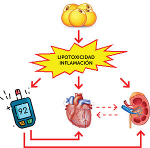Concepto de síndrome metabólico-cardio-renal. La lipotoxicidad e inflamación derivadas de la obesidad sumadas a la hiperglicemia secundaria a la diabetes constituyen el síndrome metabólico cardio renal en la diabesidad. Adaptado de Ndumele, et al. (2023)22.