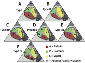 Nomenclatura de la válvula tricúspide. Esquema Hahn RT, et al. (2021)13.
