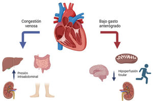 Insuficiencia tricuspídea, fisiopatología Elaboración propia, creado con BioRender.com.