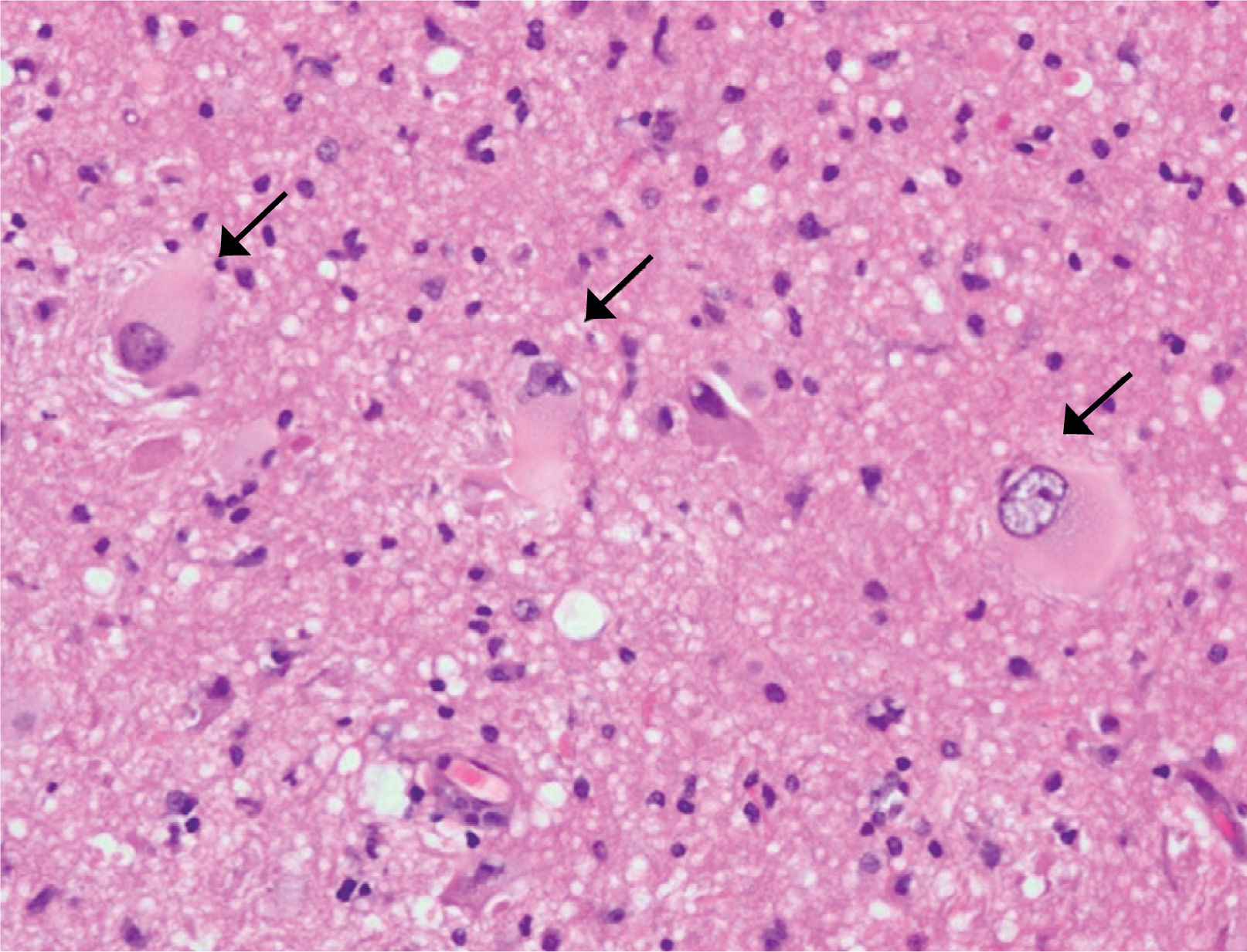 fig0015