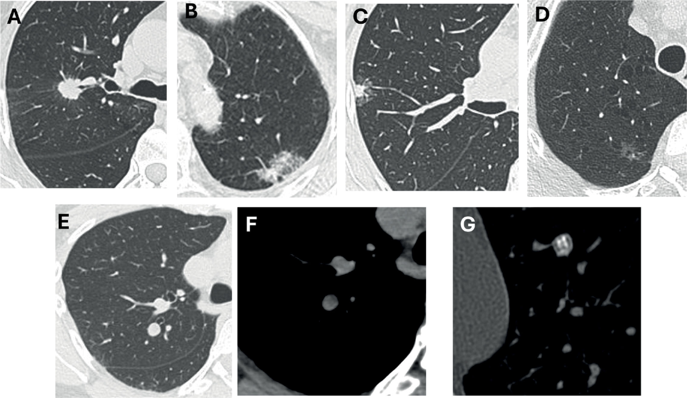 fig0015