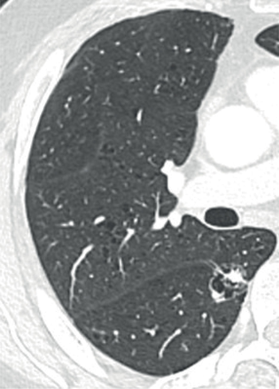 fig0020