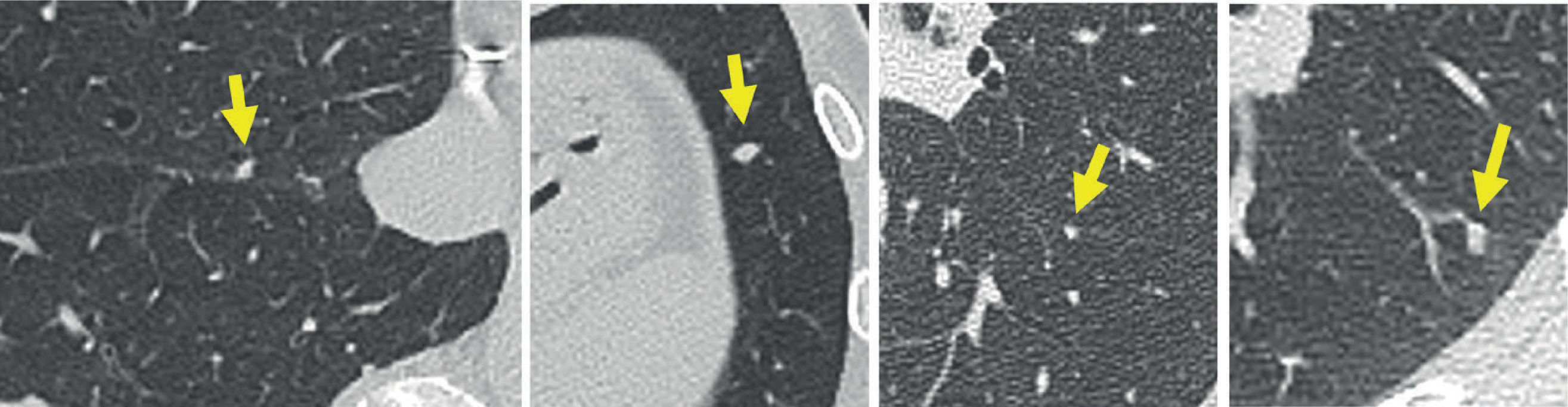 fig0030
