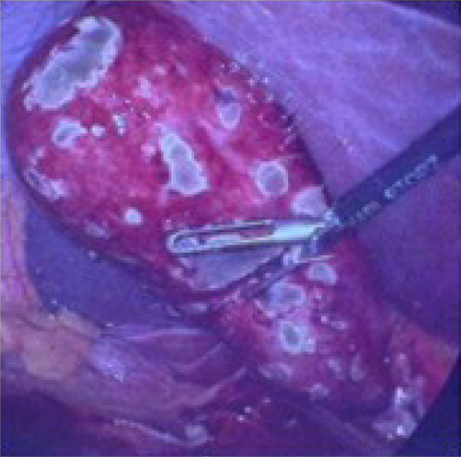 fig0010