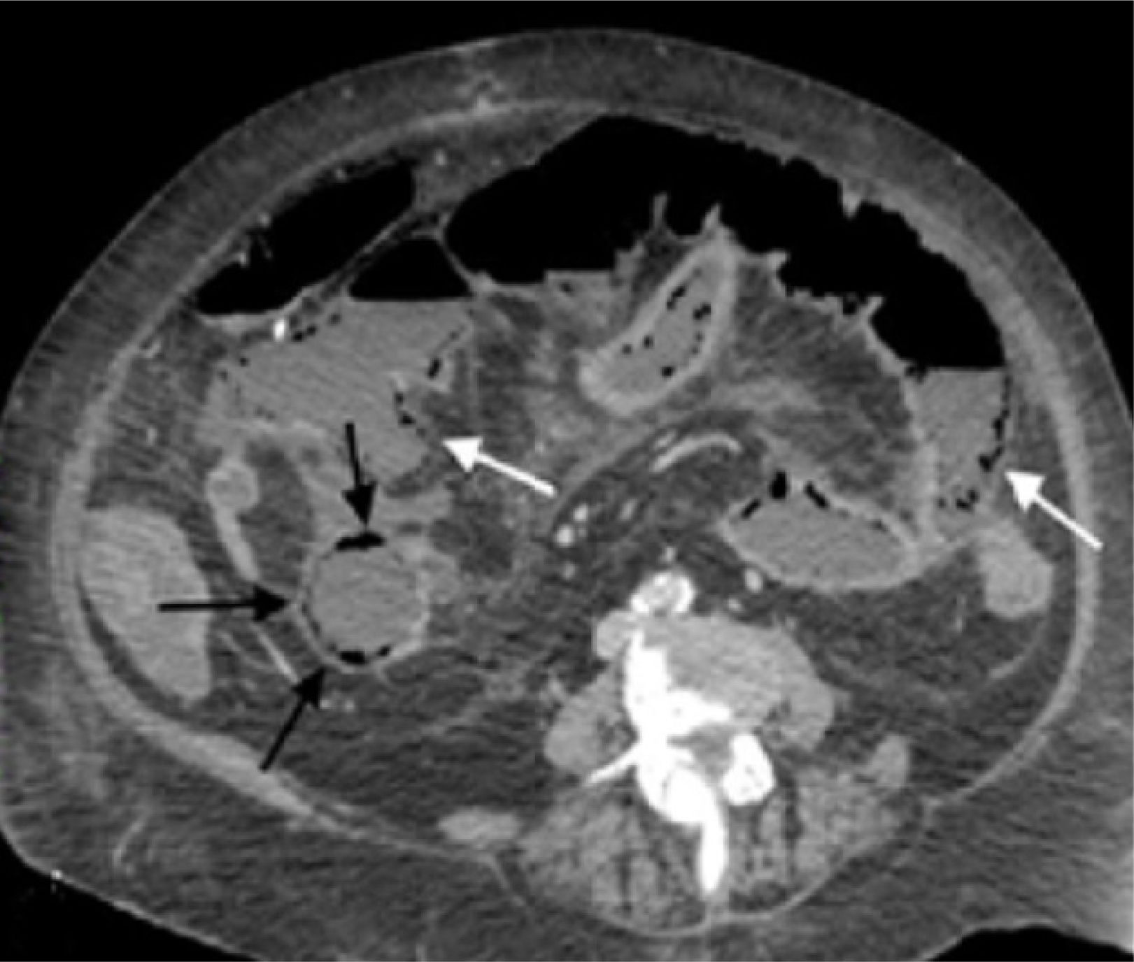 fig0015