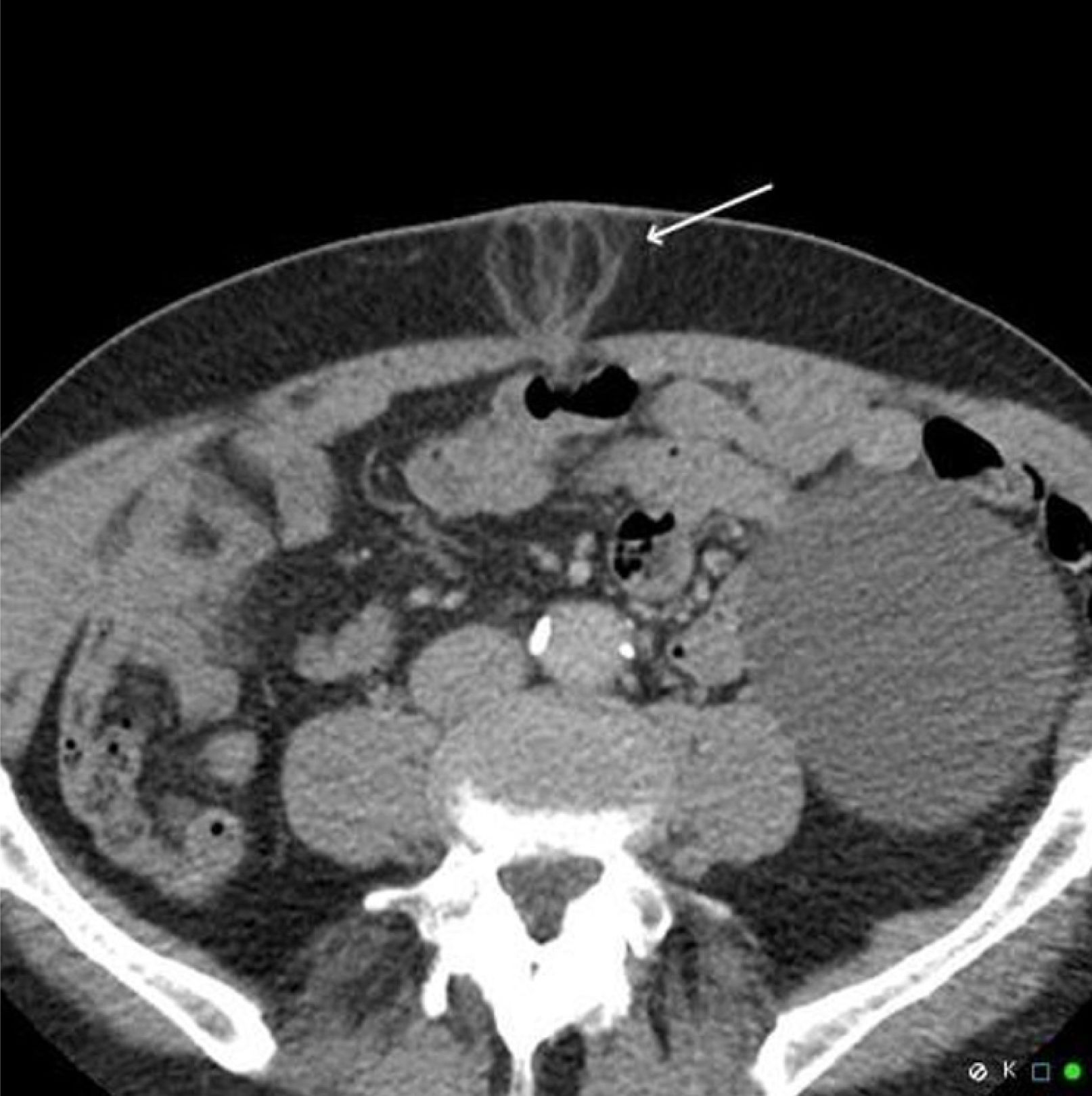 fig0020