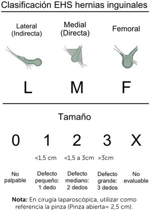 Clasificación de hernias inguinales Fuente: elaboración propia basada en la clasificación de la European Hernia Society (EHS). Muysoms FE et al.10 NOTA: En cirugía laparoscópica, utilizar como referencia la pinza (Pinza abierta= 2,5 cm).