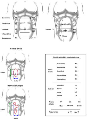 Clasificación de hernias ventrales e incisionales según la European Hernia Society (EHS). Fuente: Adaptado de Muysoms FE, et al.10.