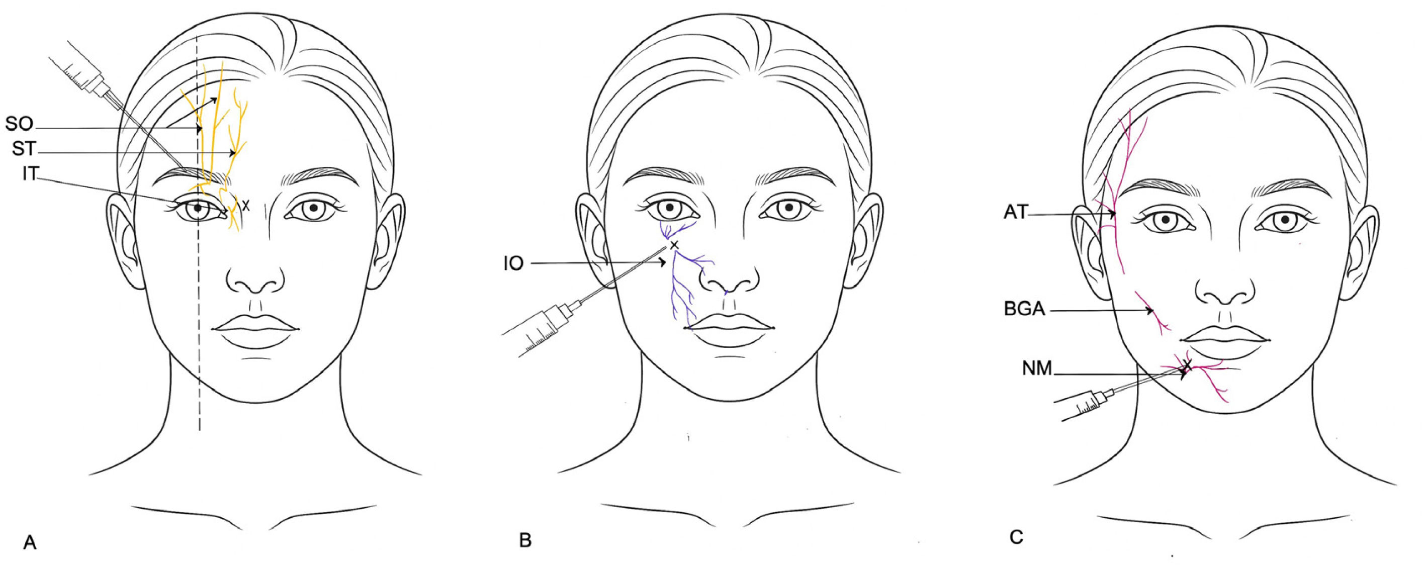 fig0010