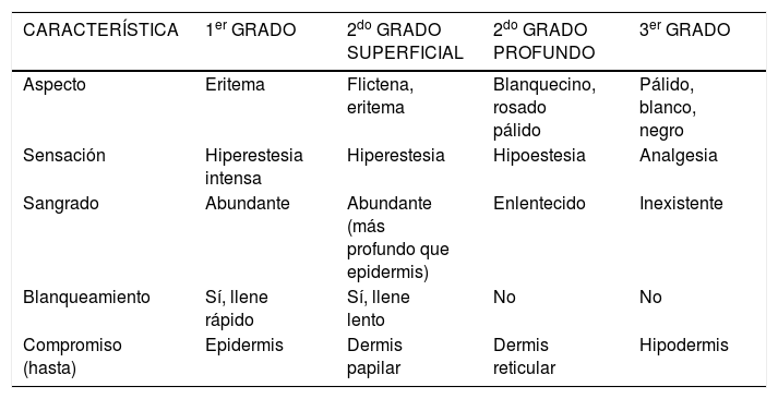 Tablas