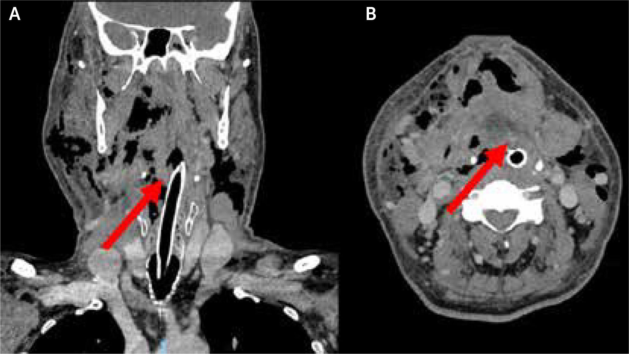 fig0055