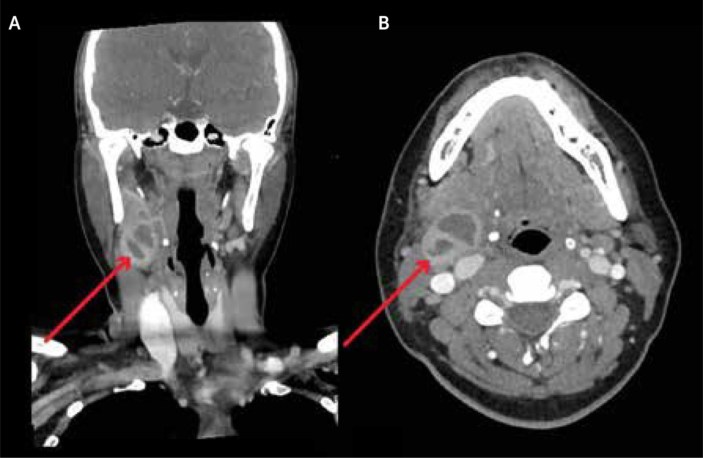 fig0020
