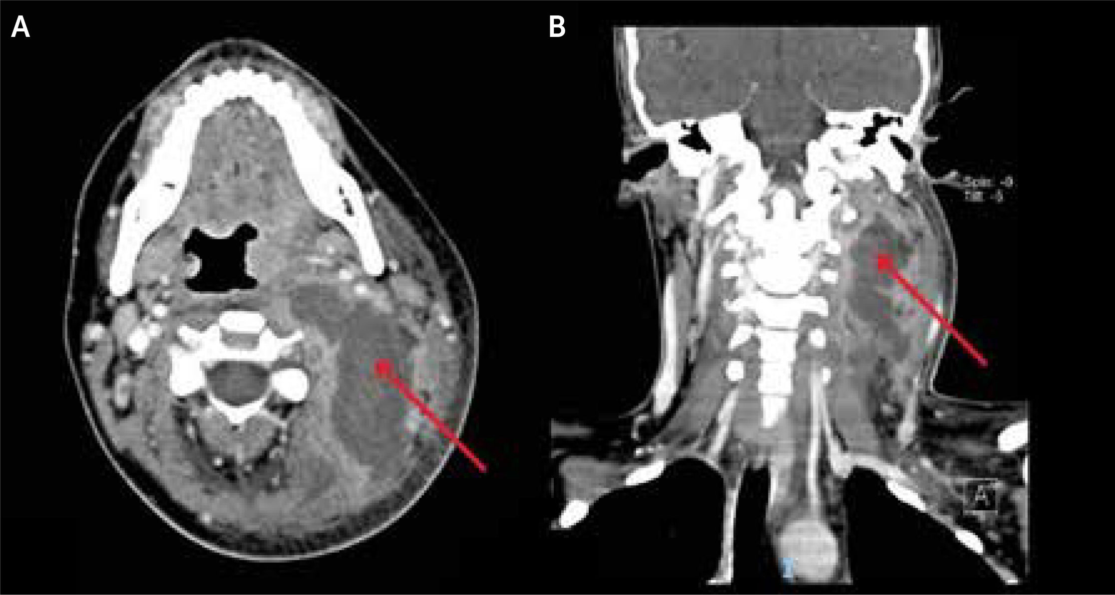 fig0025