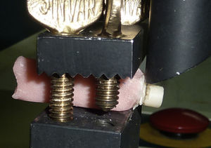 Momento justo en que se produce la falla a nivel de la interfase diente-restauración.