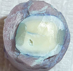 Corte transversal del cuerpo de prueba luego de termociclado, para medir la filtración marginal.