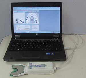 Sistema T-Scan® III instalado en notebook, tal como se utiliza en la clínica odontológica.