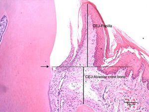 Photomicrography at 100× magnification (10× objective and 10× ocular) of the mesial region of the mandibular first molar. It shows the measurements of the distance from the cemento-enamel junction to the papilla (CEJ-papilla) and the cemento-enamel junction to the bone crest. Arrow: cemento-enamel junction (CEJ); Bar: 50μm.