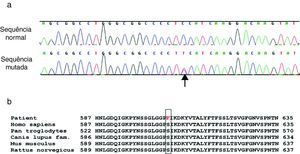 a) Mutação, em heterozigotia, c.1817 C>T p.S606F (seta), do gene KCNH2. A linha superior corresponde à sequenciação de um controlo normal. b) Homologia da sequenciação de aminoácidos em diferentes espécies testados com o programa NCBI HomoloGene (http://www.ncbi.nlm.nih.gov/homologene). O codão p.S606 mostra homologia nas diferentes espécies.