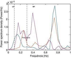 Alterações na análise espectral (Fast Fourier Transform) dos intervalos RR em condições basais (linha vermelha) e durante estimulação autonómica (tronco simpático torácico – linha magenta, vago cervical direito – linha azul). LF=low-frequency; HF=high-frequency.