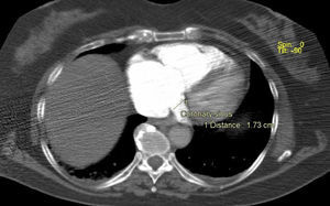 Medição do SC por <span class=