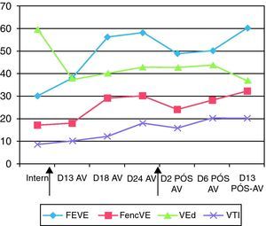 Melhoria gradual da função cardíaca e diminuição da dilatação do ventrículo esquerdo após início de assistência ventricular. As setas pretas indicam, da esquerda para a direita, implantação e retirada da assistência ventricular externa. AVE: assistência ventricular externa; FEVE: fração de ejeção; FencVE: fração de encurtamento; VEd: diâmetro do ventrículo esquerdo em diástole; VTI: integral velocidade tempo na câmara de saída do ventrículo esquerdo.