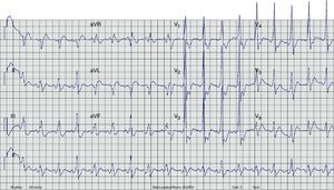 Twelve-lead <span class=